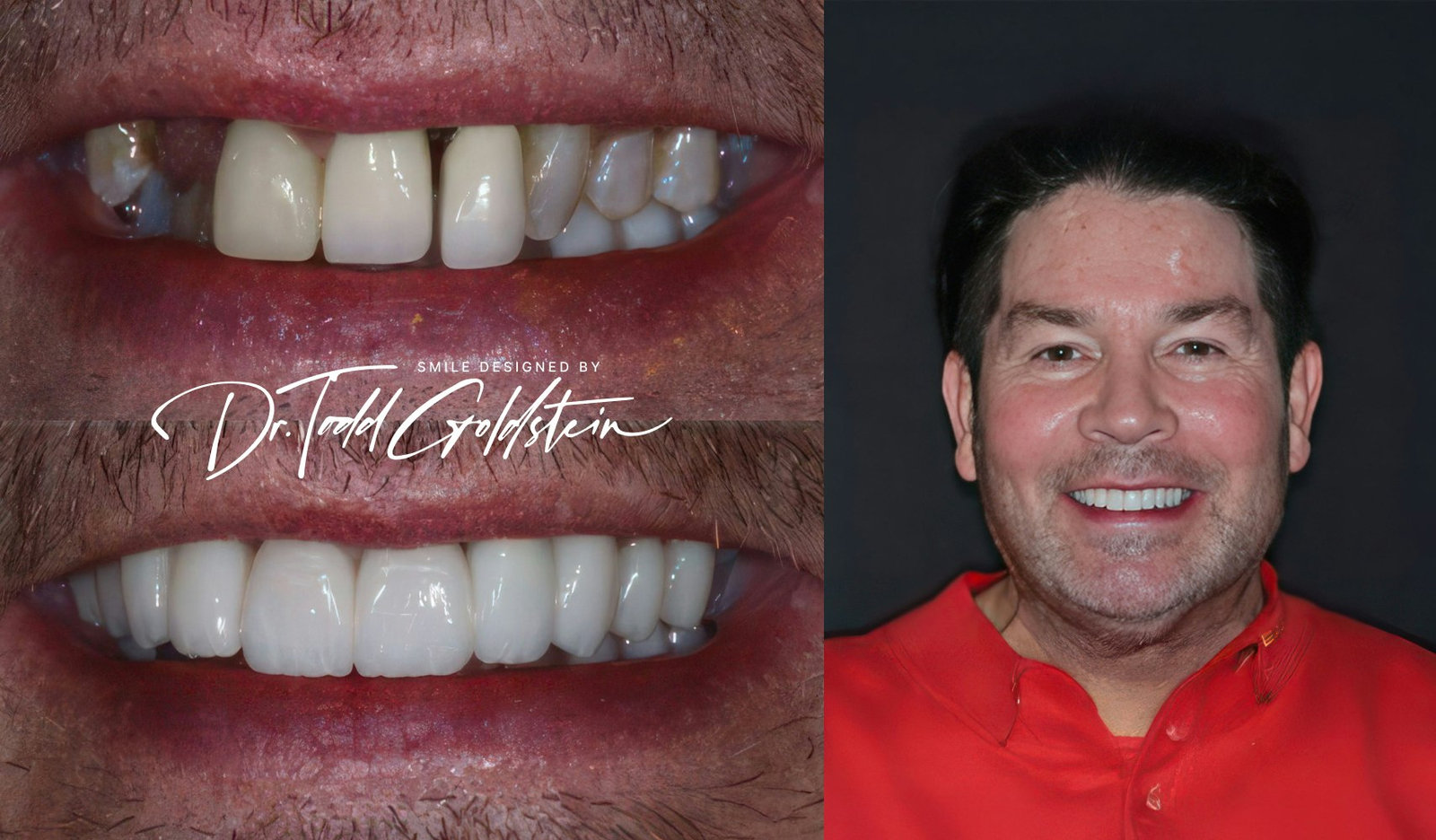 Edward's smile and portrait after dental implants and cosmetic dentistry
