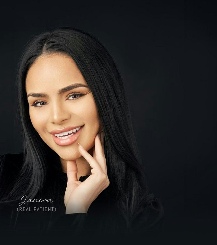 Smile makeover patient