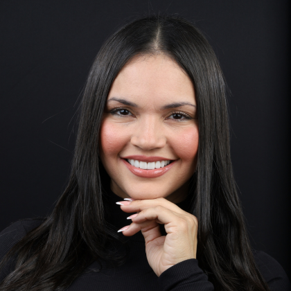 SmileSculpt Veneers before and after