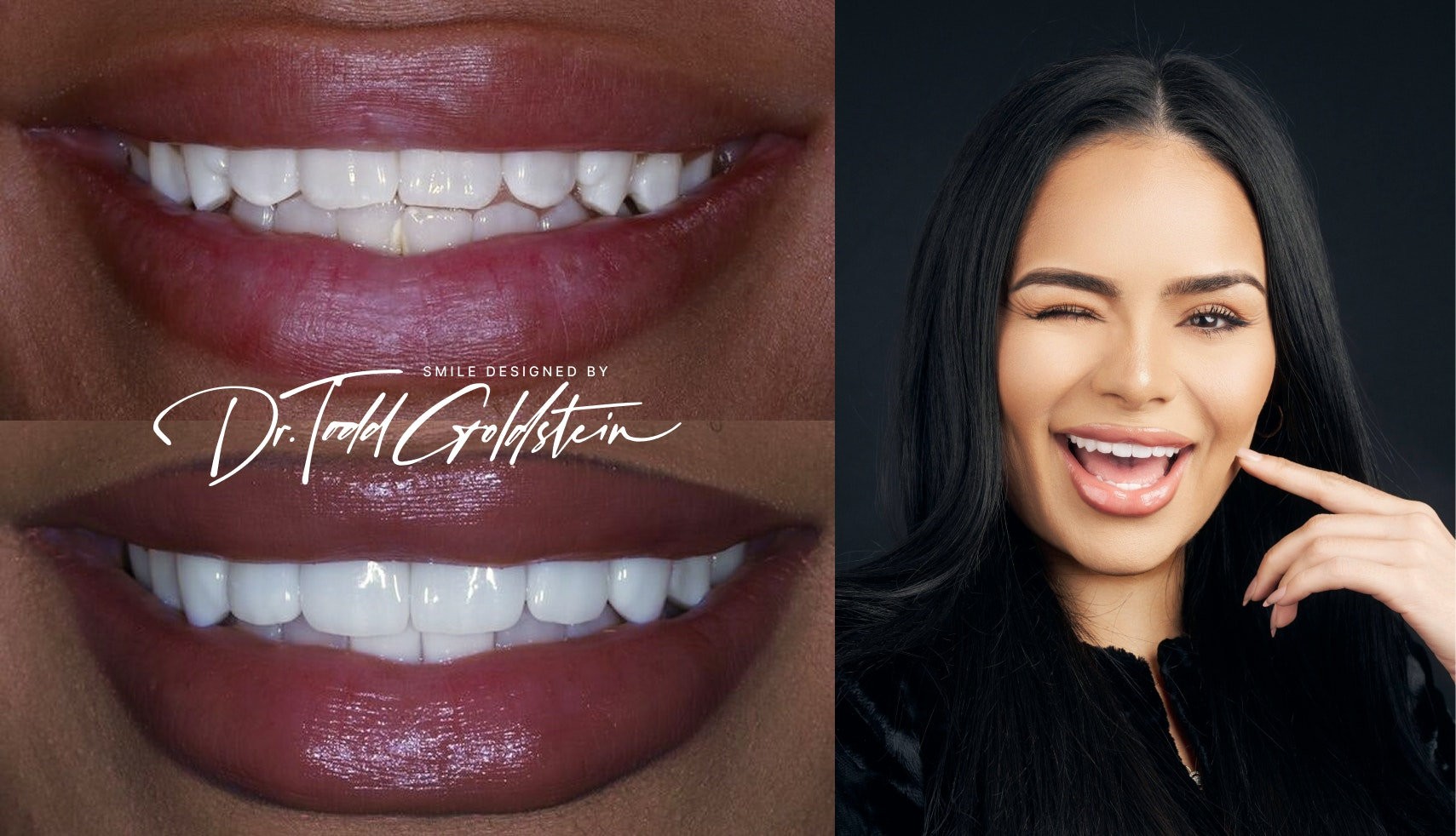 Janira's smile and portrait after veneers