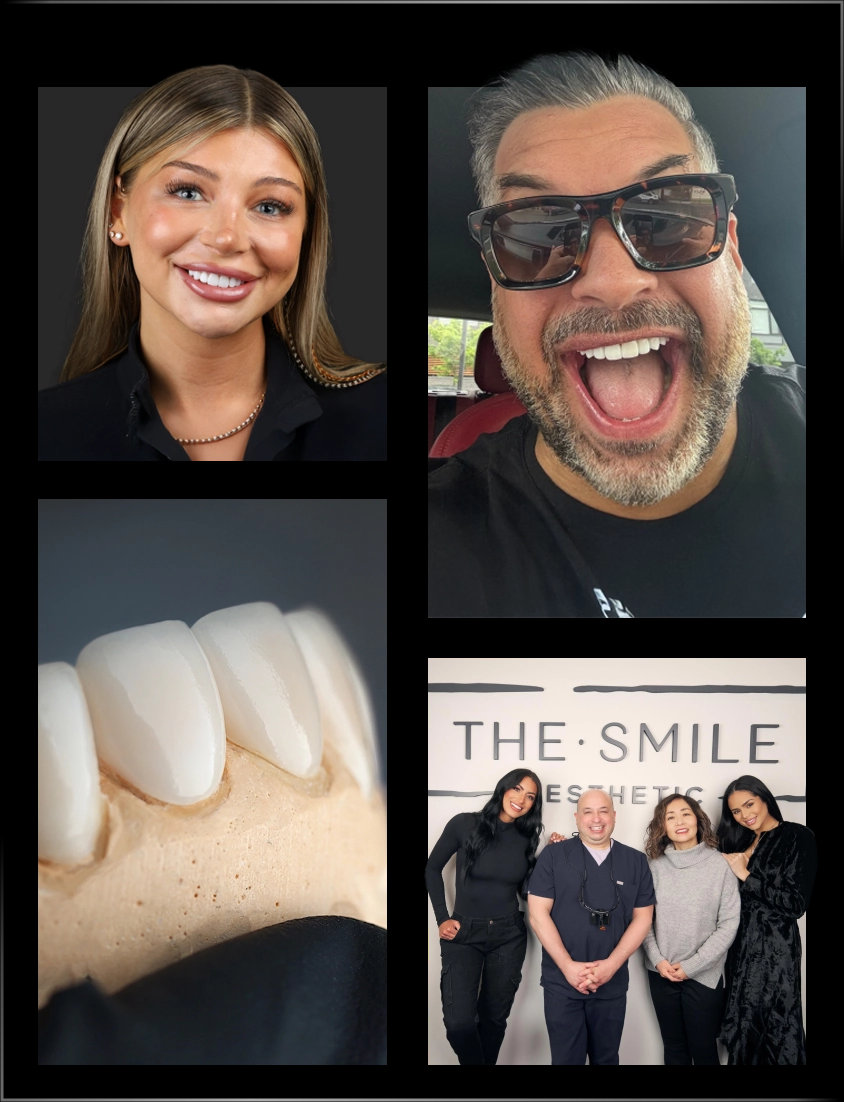 Collage of veneer patients, a porcelain veneer and the team