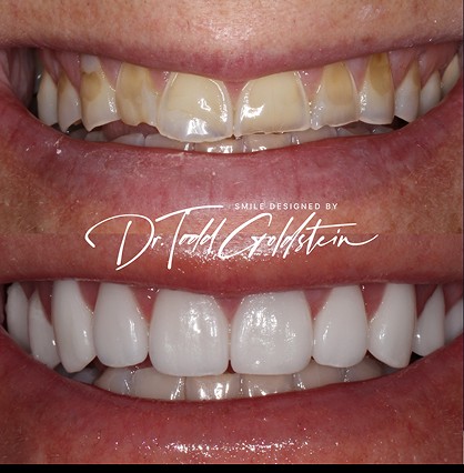 Layla's smile after cosmetic dentistry